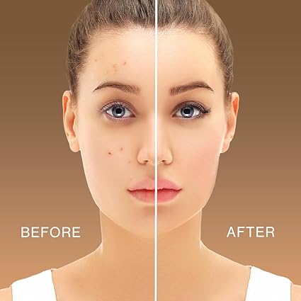 HD Concealer (Pack of 4)